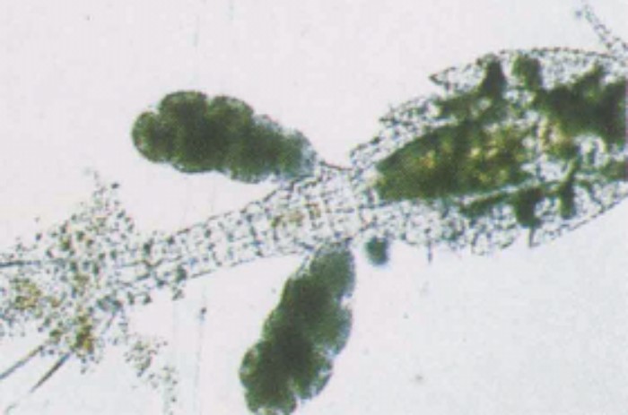 接触ばっ気槽に出現する微生物